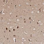 PKA beta Antibody in Immunohistochemistry (Paraffin) (IHC (P))