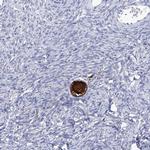 SMS Antibody in Immunohistochemistry (Paraffin) (IHC (P))