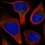 SMS Antibody in Immunocytochemistry (ICC/IF)