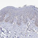 SMS Antibody in Immunohistochemistry (Paraffin) (IHC (P))