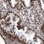 NuMA Antibody in Immunohistochemistry (Paraffin) (IHC (P))