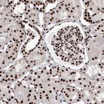 NuMA Antibody in Immunohistochemistry (Paraffin) (IHC (P))