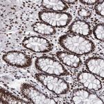 NuMA Antibody in Immunohistochemistry (Paraffin) (IHC (P))