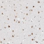 SMARCA2 Antibody in Immunohistochemistry (Paraffin) (IHC (P))