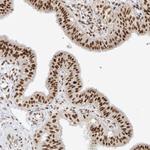 SMARCA2 Antibody in Immunohistochemistry (Paraffin) (IHC (P))