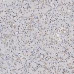 SMARCA2 Antibody in Immunohistochemistry (Paraffin) (IHC (P))