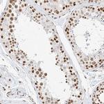 SMARCA2 Antibody in Immunohistochemistry (Paraffin) (IHC (P))