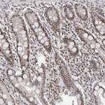 ATF5 Antibody in Immunohistochemistry (Paraffin) (IHC (P))