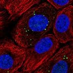 Filaggrin Antibody in Immunocytochemistry (ICC/IF)