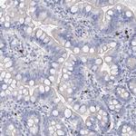 Filaggrin Antibody in Immunohistochemistry (Paraffin) (IHC (P))