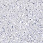 Filaggrin Antibody in Immunohistochemistry (Paraffin) (IHC (P))