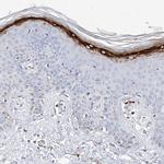 Filaggrin Antibody in Immunohistochemistry (Paraffin) (IHC (P))