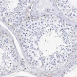 Filaggrin Antibody in Immunohistochemistry (Paraffin) (IHC (P))