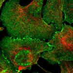 Afadin Antibody in Immunocytochemistry (ICC/IF)