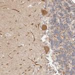 Afadin Antibody in Immunohistochemistry (Paraffin) (IHC (P))