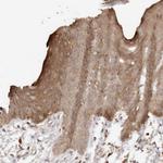 Afadin Antibody in Immunohistochemistry (Paraffin) (IHC (P))