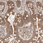 Afadin Antibody in Immunohistochemistry (Paraffin) (IHC (P))