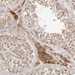 Afadin Antibody in Immunohistochemistry (Paraffin) (IHC (P))