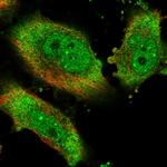 eIF4H Antibody in Immunocytochemistry (ICC/IF)