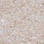 MIPEP Antibody in Immunohistochemistry (Paraffin) (IHC (P))