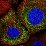 Cytokeratin 13 Antibody in Immunocytochemistry (ICC/IF)