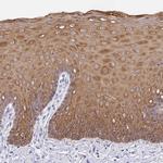 Cytokeratin 13 Antibody in Immunohistochemistry (Paraffin) (IHC (P))