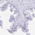 Cytokeratin 13 Antibody in Immunohistochemistry (Paraffin) (IHC (P))