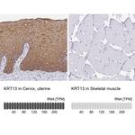 Cytokeratin 13 Antibody