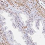 Calpain 11 Antibody in Immunohistochemistry (Paraffin) (IHC (P))