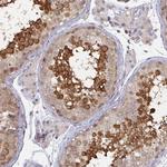 Calpain 11 Antibody in Immunohistochemistry (Paraffin) (IHC (P))