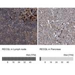 RECQ1 Antibody