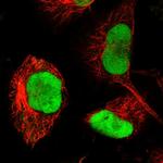 RECQ1 Antibody in Immunocytochemistry (ICC/IF)