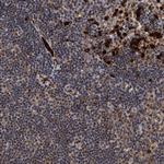 RECQ1 Antibody in Immunohistochemistry (Paraffin) (IHC (P))