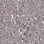 RECQ1 Antibody in Immunohistochemistry (Paraffin) (IHC (P))