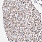 KAO Antibody in Immunohistochemistry (Paraffin) (IHC (P))