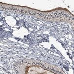 CD133 Antibody in Immunohistochemistry (Paraffin) (IHC (P))