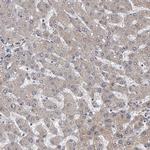 CD133 Antibody in Immunohistochemistry (Paraffin) (IHC (P))