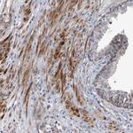 CD133 Antibody in Immunohistochemistry (Paraffin) (IHC (P))