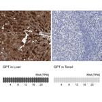 GPT Antibody