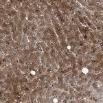 GPT Antibody in Immunohistochemistry (Paraffin) (IHC (P))