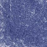 GPT Antibody in Immunohistochemistry (Paraffin) (IHC (P))