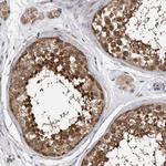 TCP1 Antibody in Immunohistochemistry (Paraffin) (IHC (P))