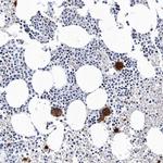 CD41 Antibody in Immunohistochemistry (Paraffin) (IHC (P))