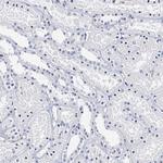 CD41 Antibody in Immunohistochemistry (Paraffin) (IHC (P))