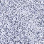 CD41 Antibody in Immunohistochemistry (Paraffin) (IHC (P))