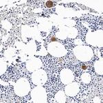 CD41 Antibody in Immunohistochemistry (Paraffin) (IHC (P))