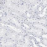 CD41 Antibody in Immunohistochemistry (Paraffin) (IHC (P))