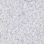 CD41 Antibody in Immunohistochemistry (Paraffin) (IHC (P))