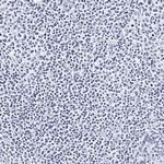 CD41 Antibody in Immunohistochemistry (Paraffin) (IHC (P))