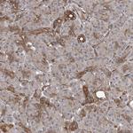 APAF1 Antibody in Immunohistochemistry (Paraffin) (IHC (P))